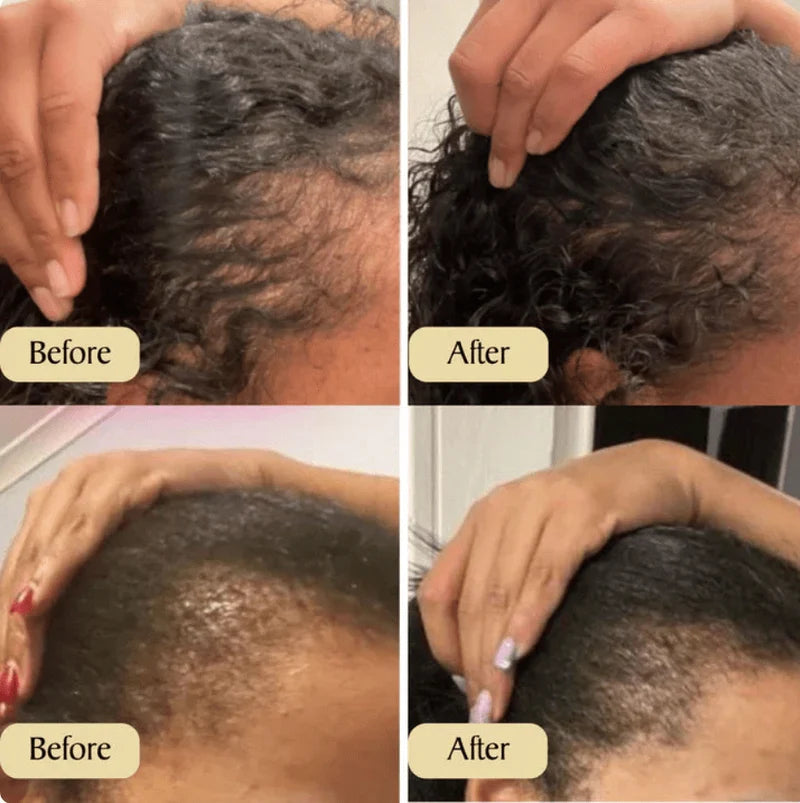 Natural Hair Growth Oil for Regrowth, Thin, Dry, Damaged Hair 1pc 60ml 2fl oz